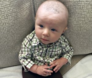 Babies and Eczema. Our story