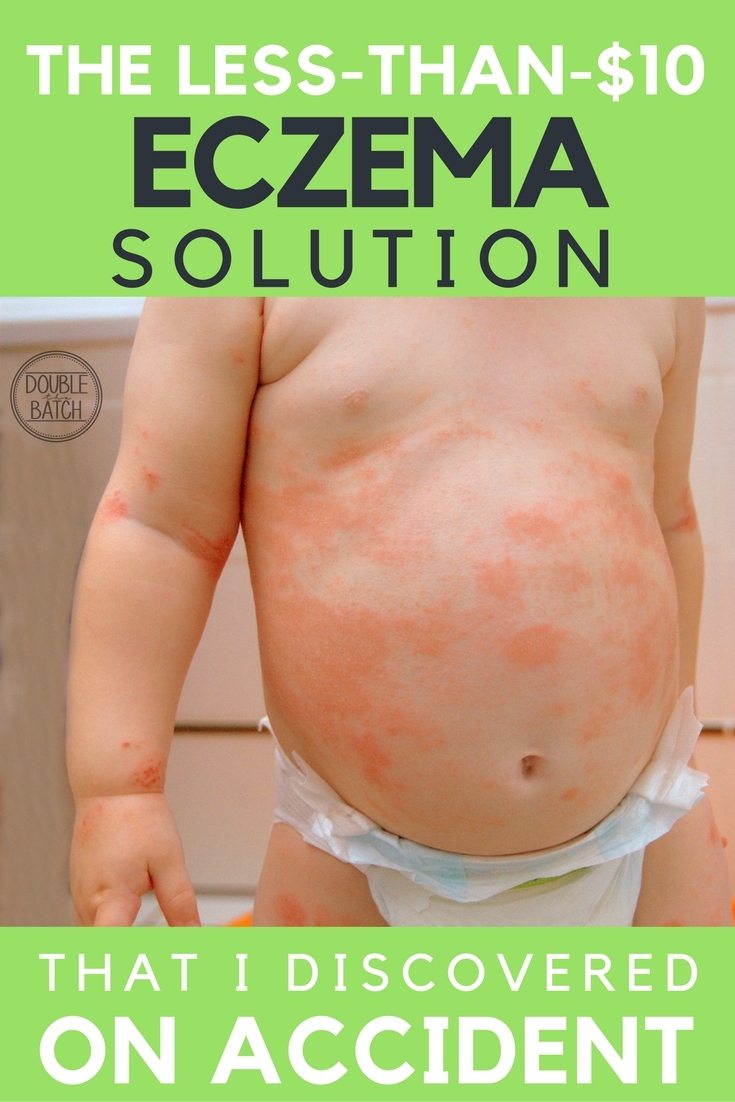 The surprising solution I found that made my baby's eczema go away and stay away